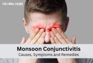 Monsoon Conjunctivitis Causes, Symptoms and Remedies