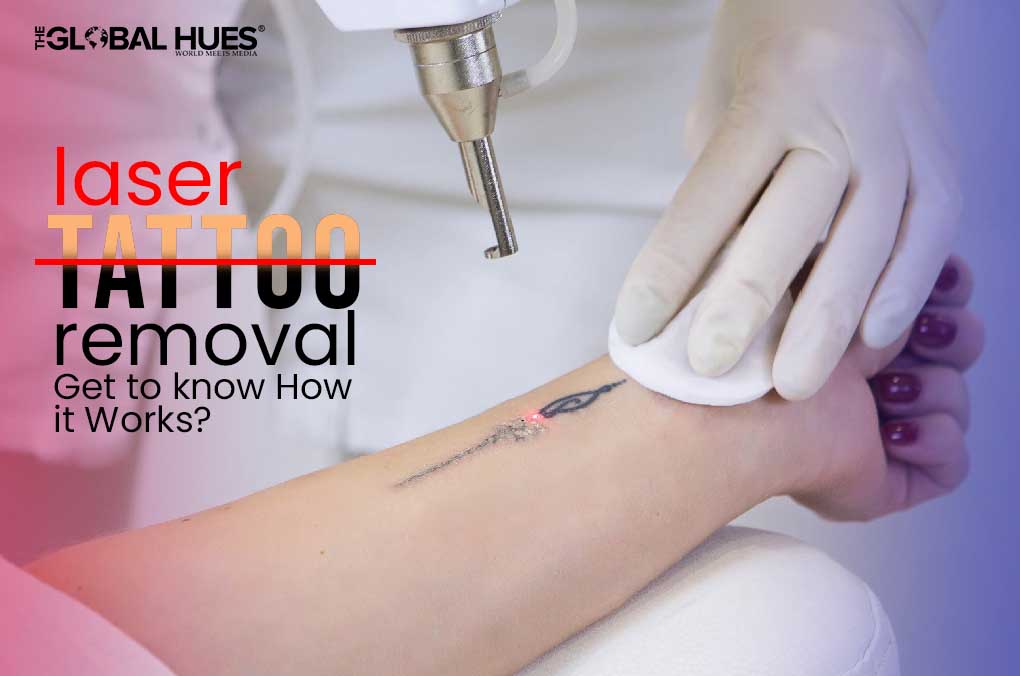 Laser Tattoo Removal: Get to know How it Works?