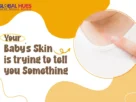 Graphic banner about baby skin health with a close-up of a child’s neck showing a red rash inside a circular frame and bold text: 'Your Baby's Skin is trying to tell you Something' on an orange and white abstract background