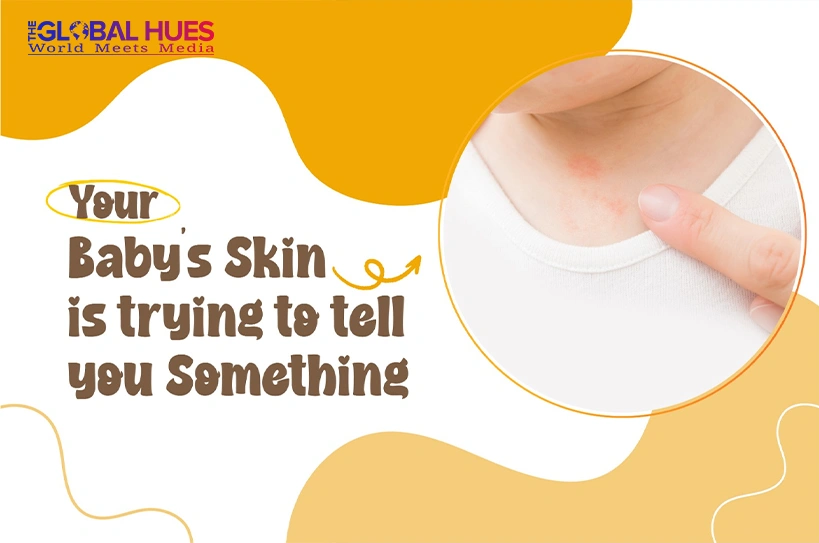 Graphic banner about baby skin health with a close-up of a child’s neck showing a red rash inside a circular frame and bold text: 'Your Baby's Skin is trying to tell you Something' on an orange and white abstract background